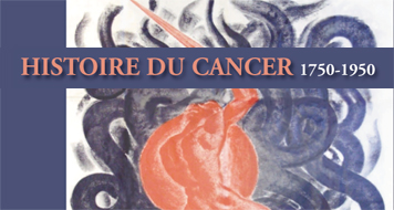 Histoire du cancer (1750-1950)